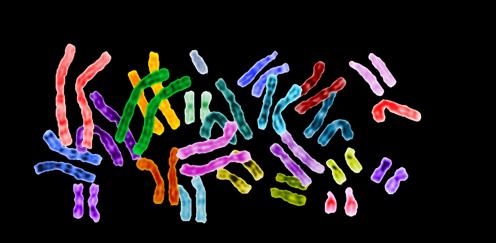 A Child's Shattered Chromosomes Illustrate the Value of Supportive
